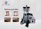 Portable 5 In 1 Body Slimming Machine Slimming Treatment Machine 1 - 50j Rf Energy