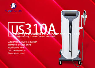 Non Invasive Hifu Facelift Machine Face Wrinkle Remover Machine 4.0 MHz