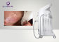 755nm 808nm 106nm Diode Laser Hair Removal Machine With Painless Treatment