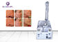 10600nm Acne Freckles Removal CO2 Fractional Laser Machine 30W Average Power